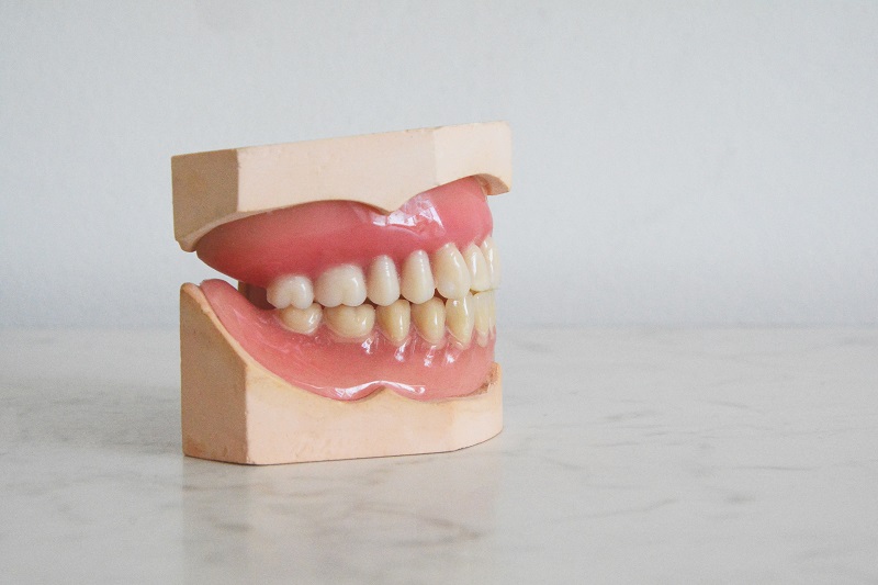 Malocclusions